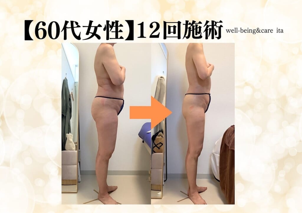 ダイエット