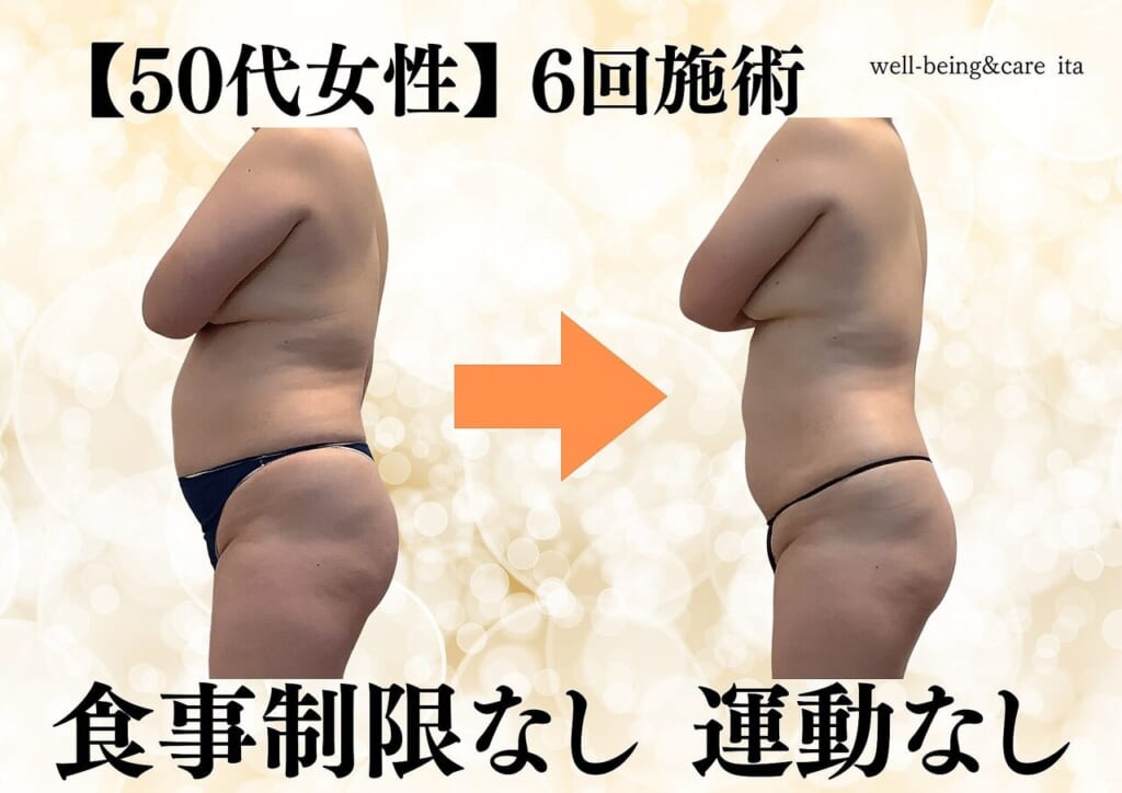 お腹痩せ ダイエット