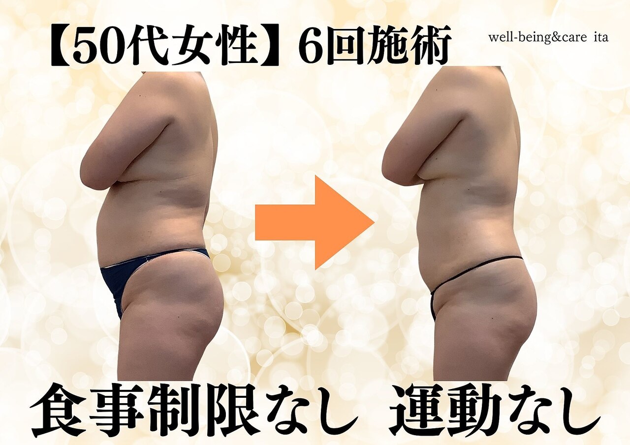 お腹痩せ　ダイエット